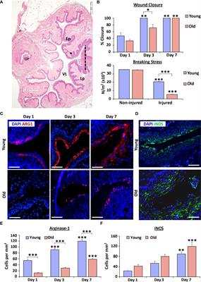 Epithelial arginase-1 is a key mediator of age-associated delayed healing in vaginal injury